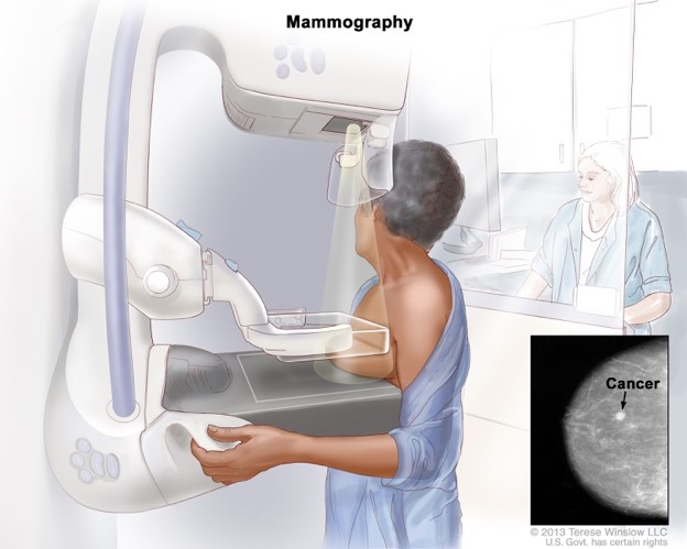 Mammografy (Early breast cancer detection) 