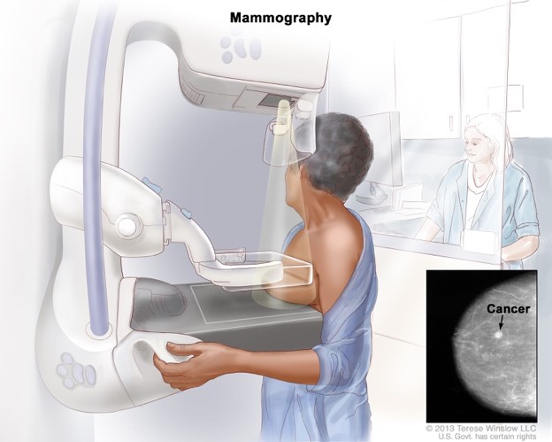 Mammografy (Early breast cancer detection)